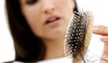 10 Best Siddha Medications for Hair Loss