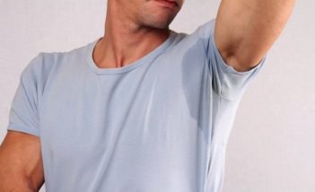 Cure excessive sweating with homeopathic medicines