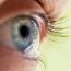 How are cataracts formed and hoe can they be prevented?