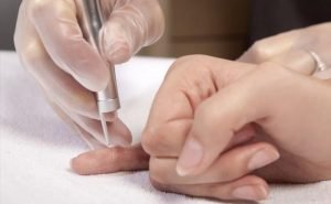How are Warts caused and are they infectious?