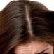 How can I get rid of dandruff?