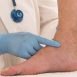 How can I prevent varicose veins?