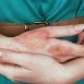 How can I take bath if my arm is fractured?