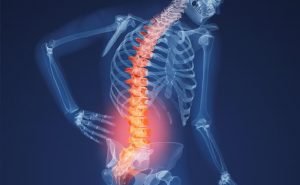 How can we prevent osteoporosis?