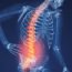 How can we prevent osteoporosis?