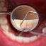 How many teeth should an adult have?