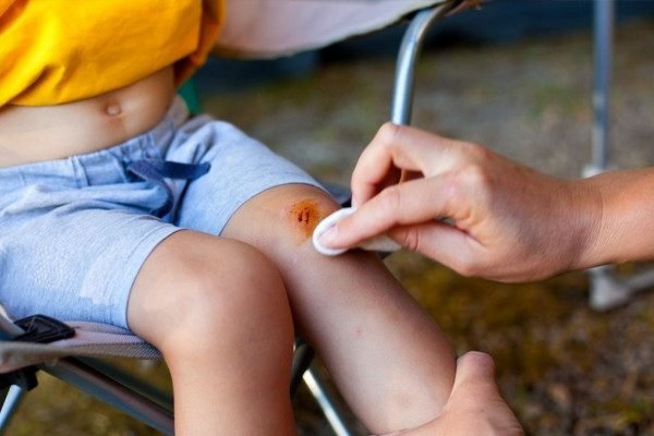 How to Cure Abrasions at Home Naturally?
