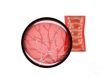 How to Cure Bacterial Vaginitis at Home Naturally?