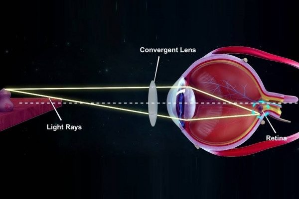 How to Cure Defective Vision at Home Naturally?