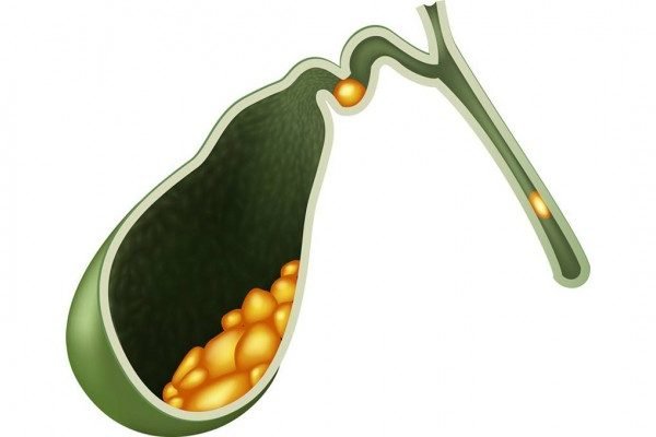 How to Cure Gallbladder Disorders at Home Naturally?