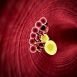 How to Cure High Blood Cholesterol at Home Naturally?