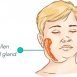How to Cure Mumps at Home Naturally?