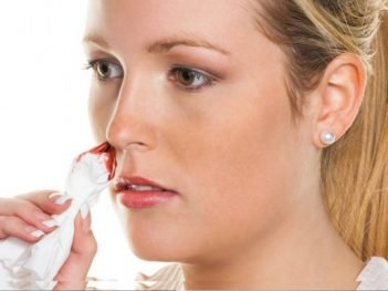 How to Cure Nose Bleeding at Home Naturally?