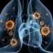How to Cure Pneumonia at Home Naturally?