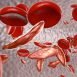How to get rid of Anaemia at Home Naturally?