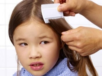 How to get rid of Lice at Home Naturally?