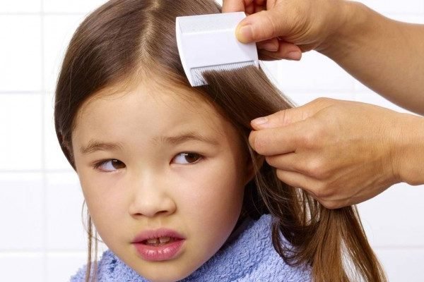 How to get rid of Lice at Home Naturally?