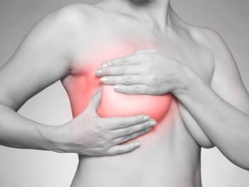 How to get rid of Mastitis at Home Naturally?