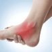 How to Get Rid of Sprain at Home Naturally?