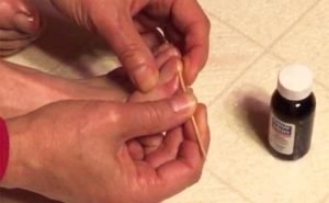 How to prevent from getting ingrowing toenails?