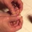 How to prevent from getting ingrowing toenails?