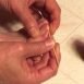 How to prevent from getting ingrowing toenails?
