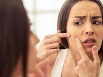 How to Remove Pimples Naturally and Permanently?