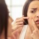 How to Remove Pimples Naturally and Permanently?