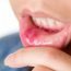 I fear I have an ulcer. How can I be sure of it?