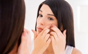 I had acne since long but it go better when I got pregnant but now again I have it. What is the reason?