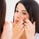I had acne since long but it go better when I got pregnant but now again I have it. What is the reason?