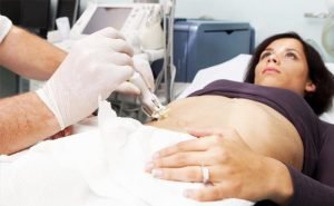 I have to get a biopsy done? what is it?