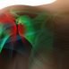 I still experience lot of pain in my shoulders although its quite some time now since I fractured them. Why is it taking so much time?