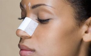 I want to know whether the doctor will give me local or general anaesthesia for my nose operation?