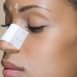 I want to know whether the doctor will give me local or general anaesthesia for my nose operation?