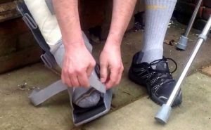 If Achilles tendon is ruptured, how is it treated?