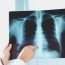 Is pneumonia dangerous?