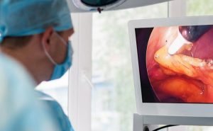 Is spleen removed in patients who suffer from anaemia?
