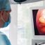Is spleen removed in patients who suffer from anaemia?