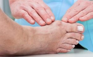 Is the operation minor for bunions?