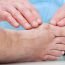 Is the operation minor for bunions?