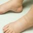 My ankles swell up a lot. What is the reason for this?