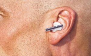 My ears are too big as a result of which I have to cover them. Can I get them operated?