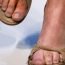 My feet swell in the hot weather. Why is it so?