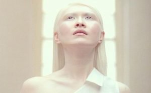 One of my friend is an albino. What is it?
