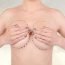 Please tell me about subcutaneous mastectomy?