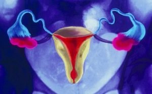 The surgeon would be doing Manchester repair for my prolapsed womb. What exactly is it?