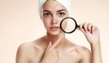 Top 6 Remedies to Cure Acne using Unani Medication