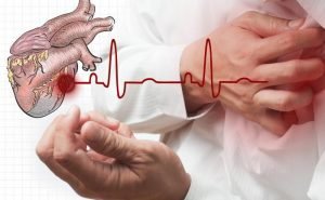What are the causes of heart attack?