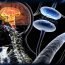 What are the causes of Parkinson's disease?